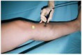 /album/fotogaleria-imagenologia/doppler-venoso-jpg/